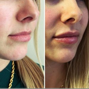 468154069_18044081783155924_6762053880170909590_n