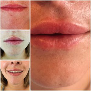 468295949_18044082848155924_2393985866597702860_n