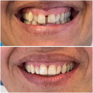 468298369_18044082584155924_8718542055991619678_n